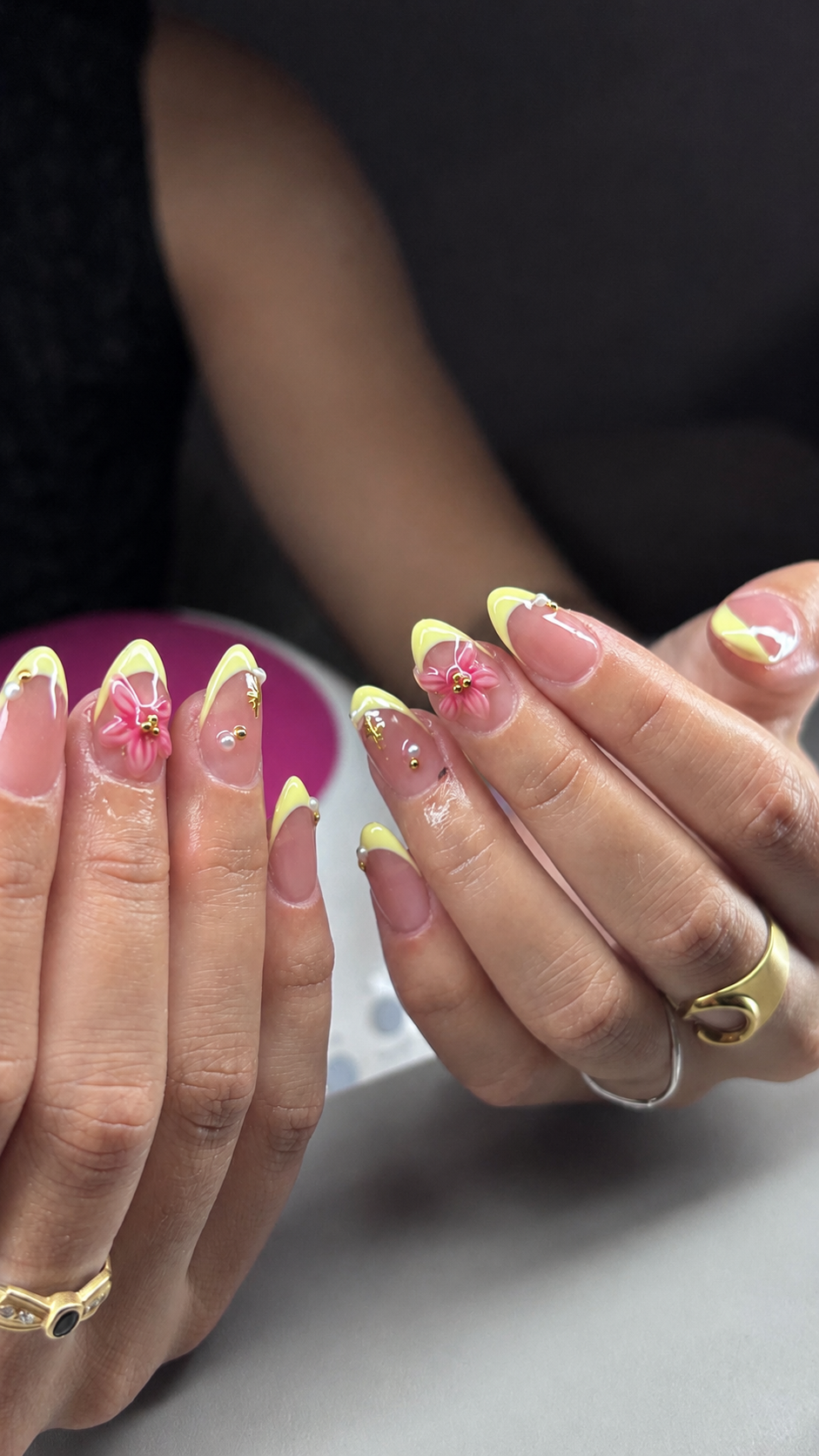 Resultado después del tratamiento de uñas
