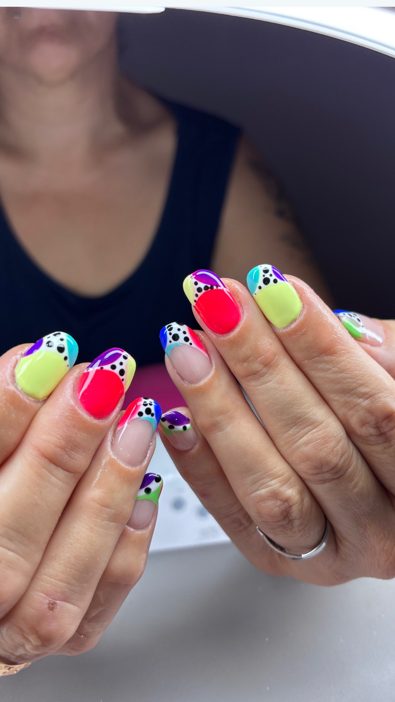 Resultado después del tratamiento de uñas